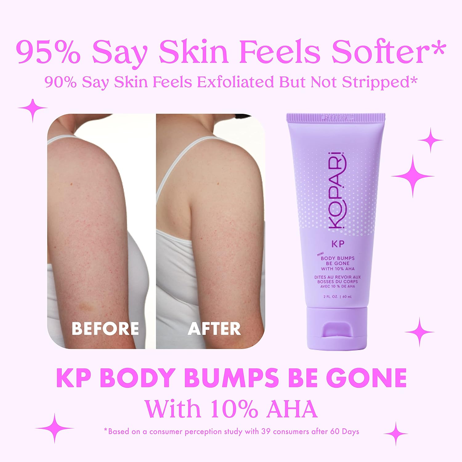 Kopari KP Body Bumps Be Gone Exfoliating Body Scrub with 10% AHA ently Exfoliate & Wash | 8.45 fl oz Tube